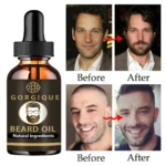 Men Natural Beard Growth Oil Moisturizing Smoothing Hair Growth Tools Dashing Gentlemen Beard Oil Conditioner Beard Care - Image 4